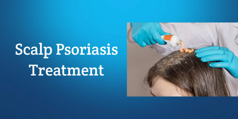 Scalp Psoriasis Treatment - Ayurvedic Psoriasis Treatment