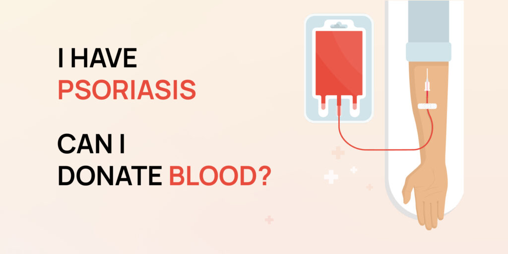 Can Psoriasis Patient Donate Blood