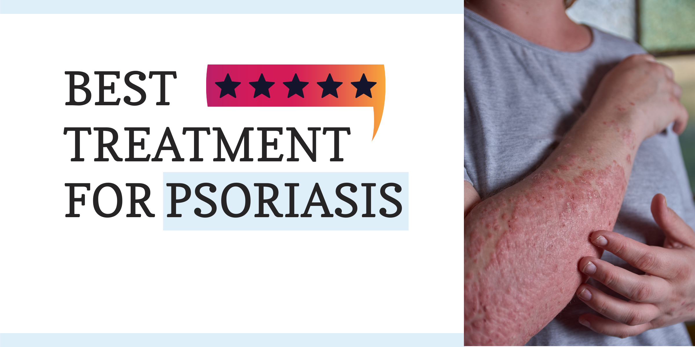 Best Treatment for Psoriasis