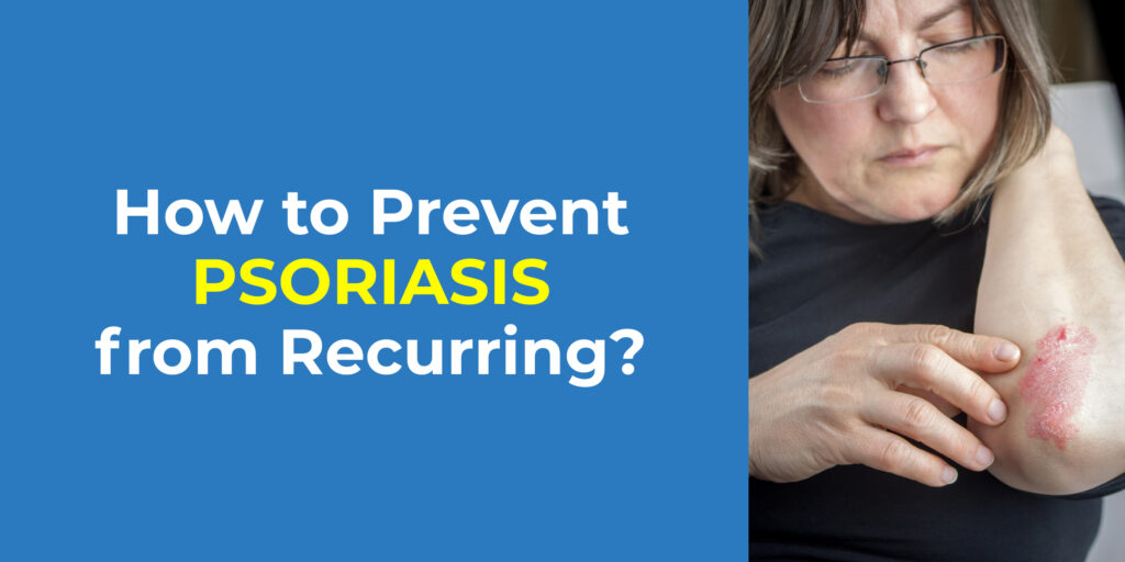 How to Prevent Psoriasis from Recurring